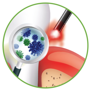 Demonstration graphic of germs through a magnifying glass